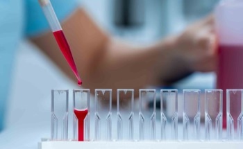 Serum-Based Raman Spectroscopy: Accurate and Non-Invasive CHD Diagnosis