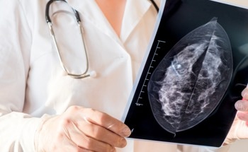 REIMS: Improving Breast Cancer Surgery with Real-Time Tissue Analysis