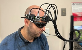 New Device Tracks Brain Blood Flow for Stroke Prevention