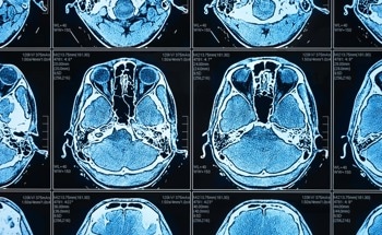 Revolutionizing Biomedical Imaging with Non-Contact Photoacoustic Technology