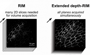 EDF-RIM: A Breakthrough in Imaging Technology