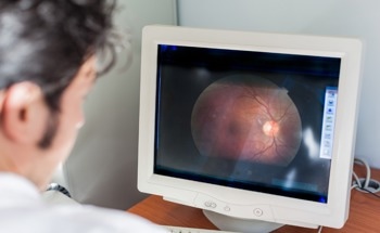 Automated Algorithm for Cone Density Assessment in Retinal Imaging