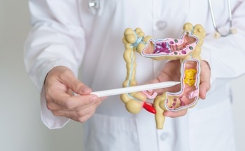Deep Learning and OCT: Advancing Colorectal Cancer Detection