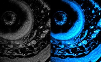 A Novel Approach to Deep-Tissue Metabolic Imaging