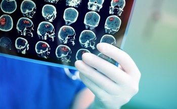 Enhancing Brain Imaging with Semi-Supervised Digital Staining and S-OCT
