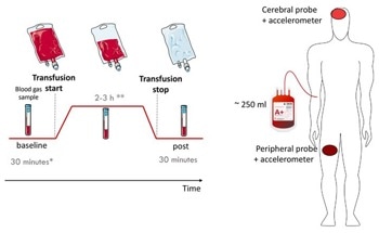 Optimizing Blood Transfusions with Noninvasive Diffuse Optics