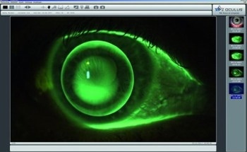 IDS: A Deep Look Into the Eye