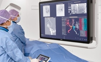 Philips Launches Intelligent 3D Imaging in Europe to Empower Faster Stroke Care, Helping Physicians Save Time, Brain, and Lives