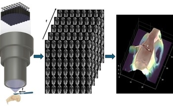New Multi-Camera Microscope Brings Real-Time 3D Precision to Surgery