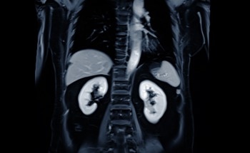 Scan of upper abdomen including pancreas.