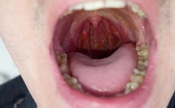 Low-Cost Optical Imaging System Brings Early Oral Cancer Detection to Dental Clinics