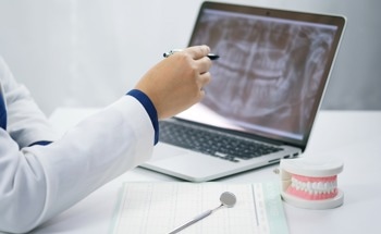 Advanced Lasers and Their Applications in Dentistry