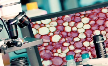 Optical Percutaneous Needle Biopsy in Oncology