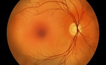 Refractive Adaptive Optics Ophthalmoscope with Fast 2D MEMS Scanner