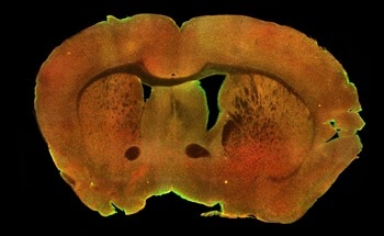 Two-Photon Imaging Reveals Brain Mitophagy Decline