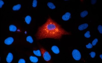 Label-Free Optical Imaging Reveals How Cancer Cells Respond to Radiation